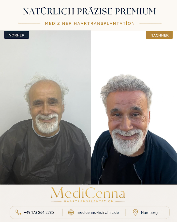 MediCenna Hair Clinic, Hamburg